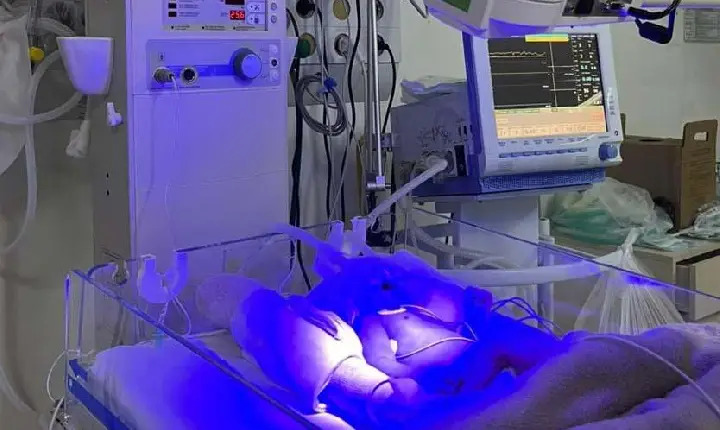 Hospital Regional do Sudoeste inicia testes da UTI Neonatal Neurológica, pioneira na rede