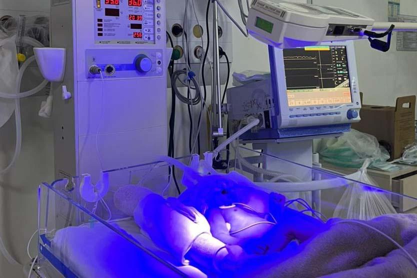 Hospital Regional do Sudoeste inicia testes da UTI Neonatal Neurológica, pioneira na rede
