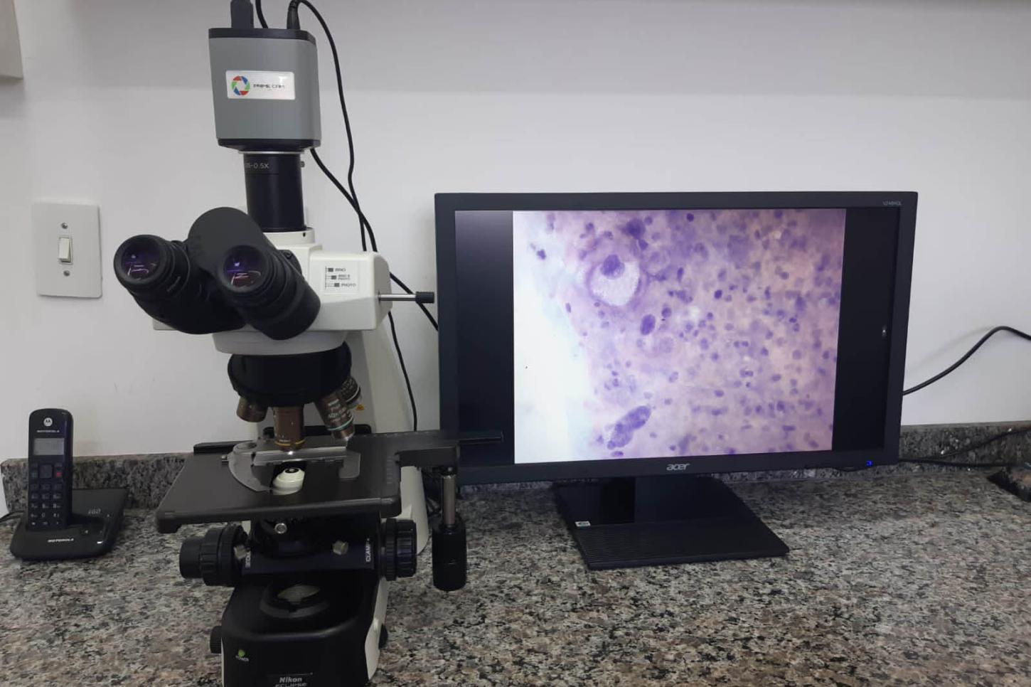 Paraná avança no combate ao câncer de colo de útero com exames em todas as cidades