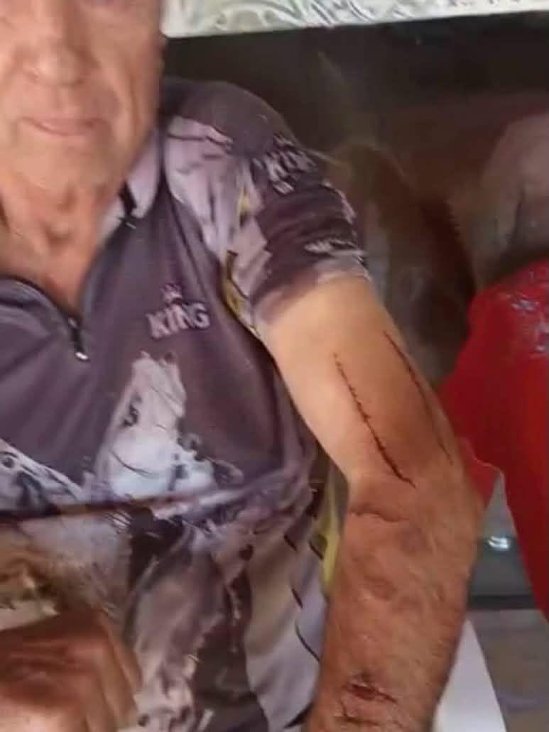 Agricultor de 76 anos sobrevive após lutar contra onça-parda em Toledo